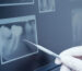 radiografia dental